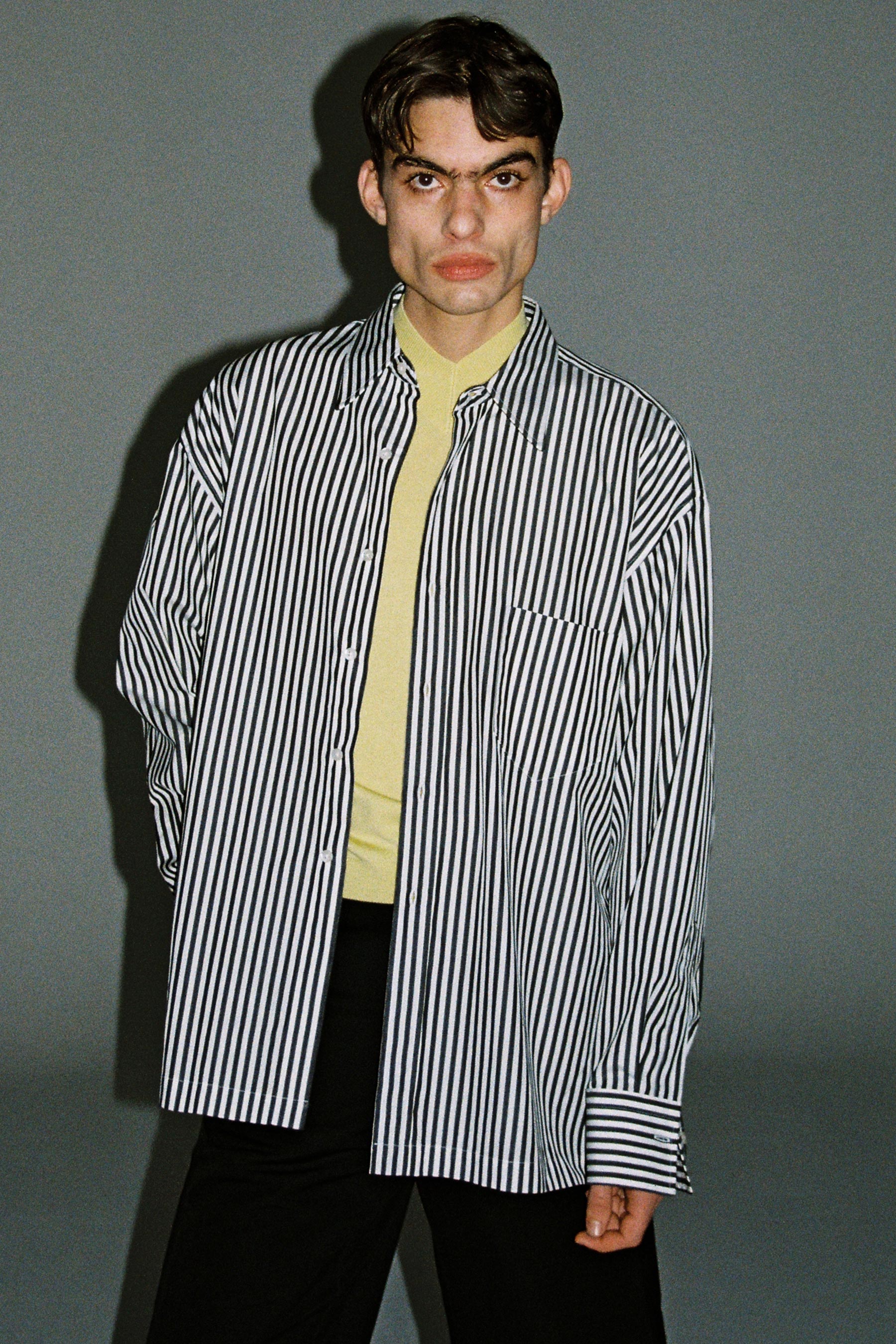 Black Stripe Cotton Square Overshirt